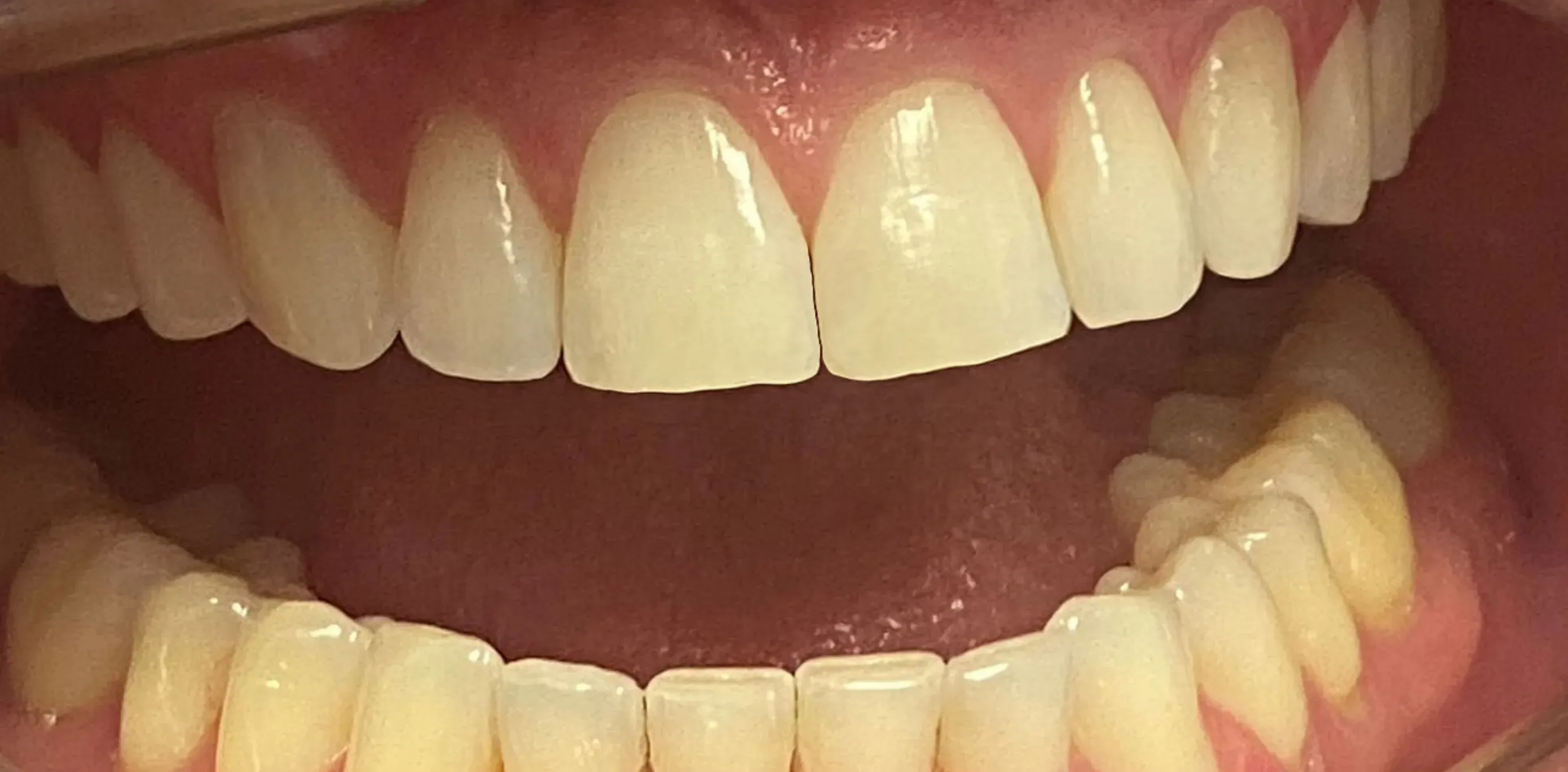 Depois do tratamento odontológico 1