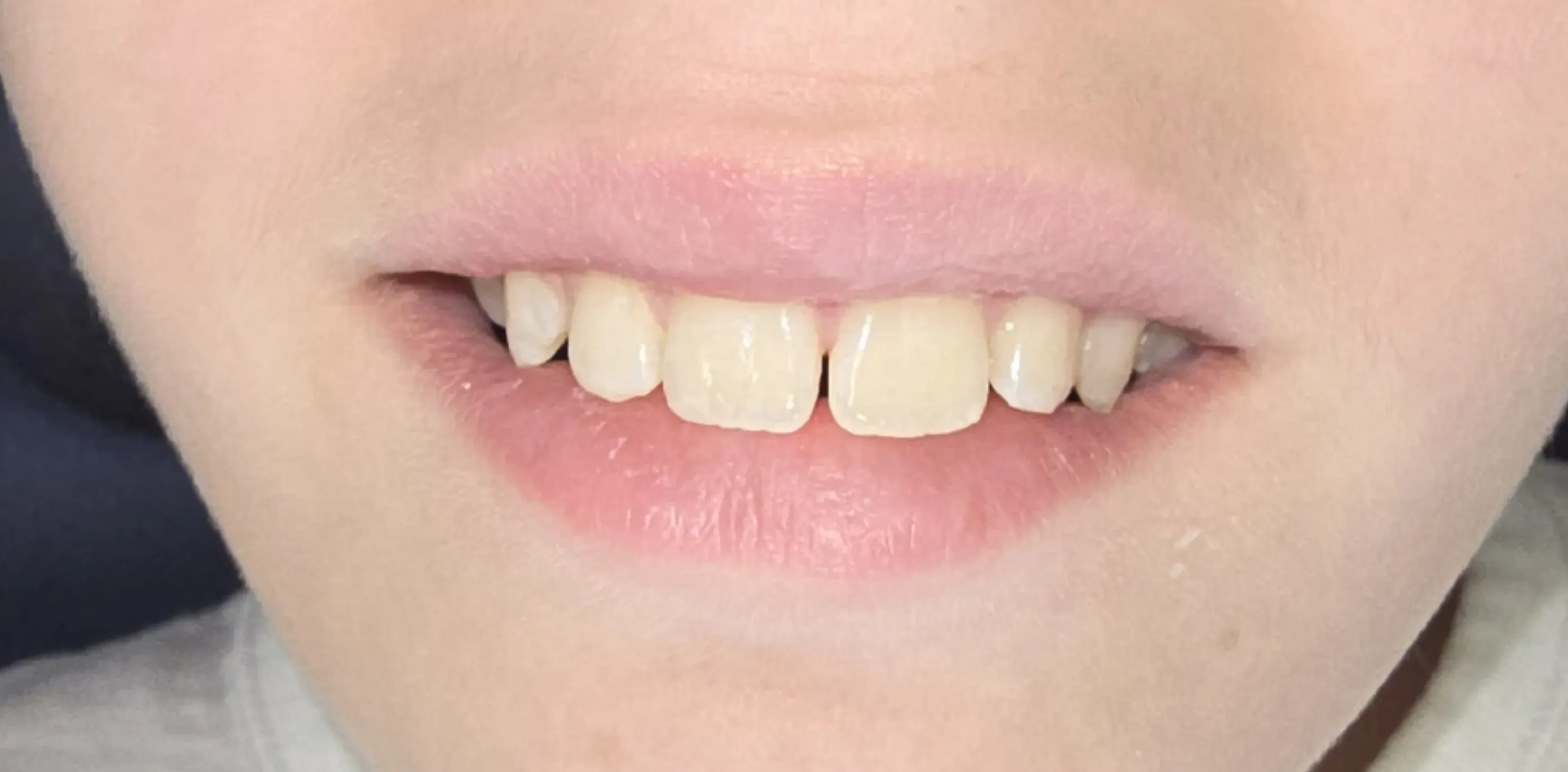 Depois do tratamento odontológico 3