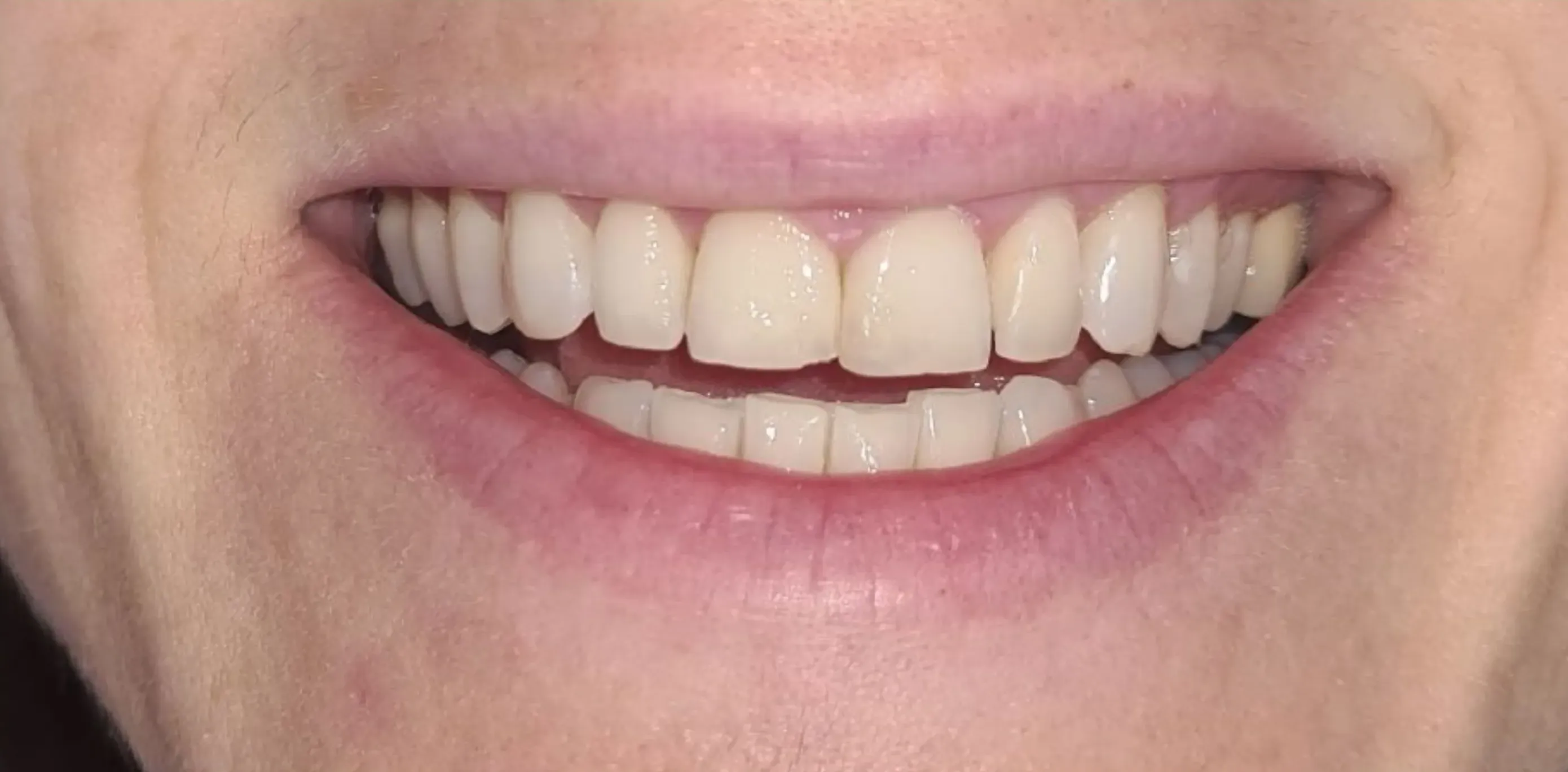 Antes do tratamento odontológico 4