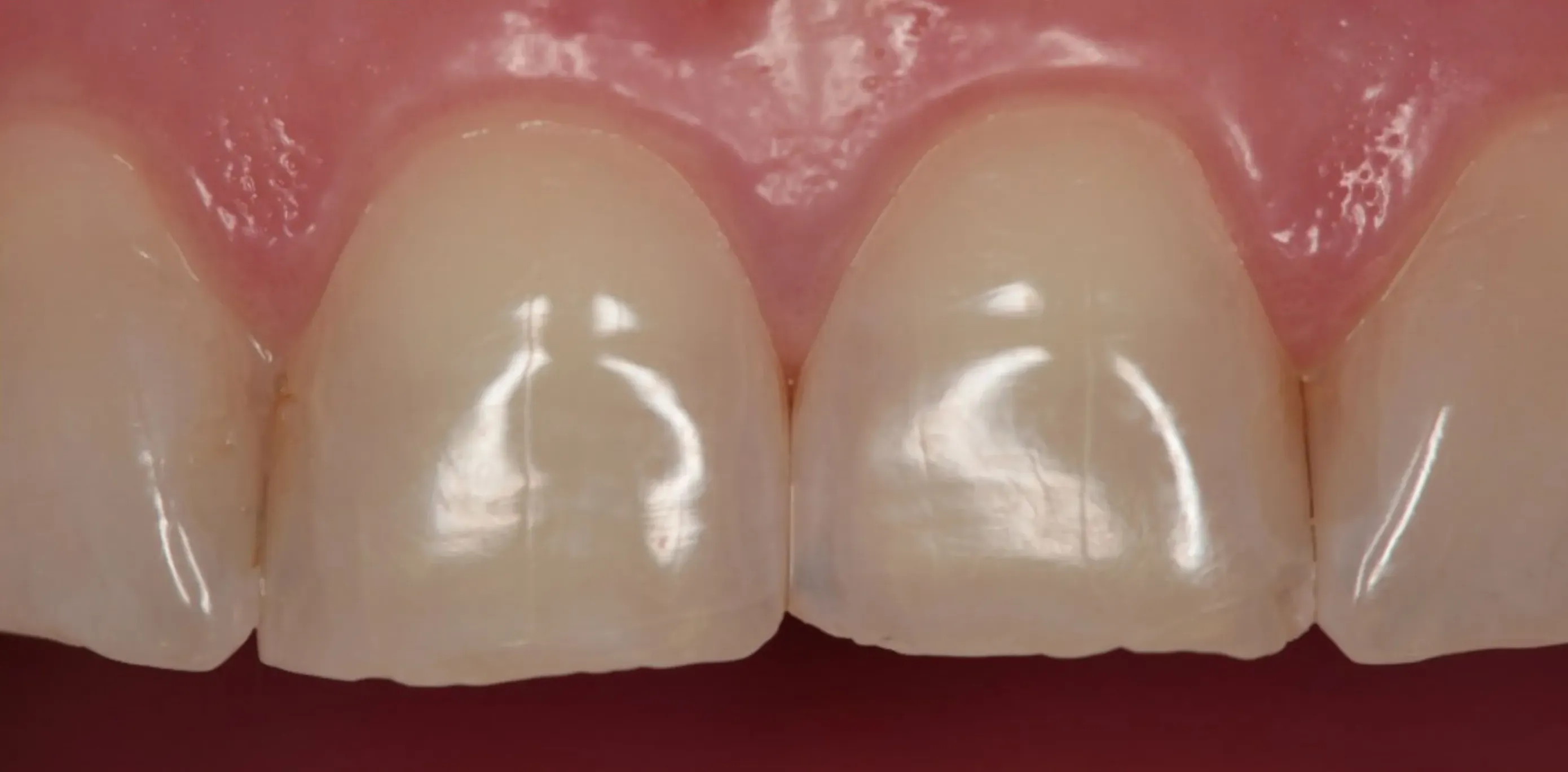 Antes do tratamento odontológico 5