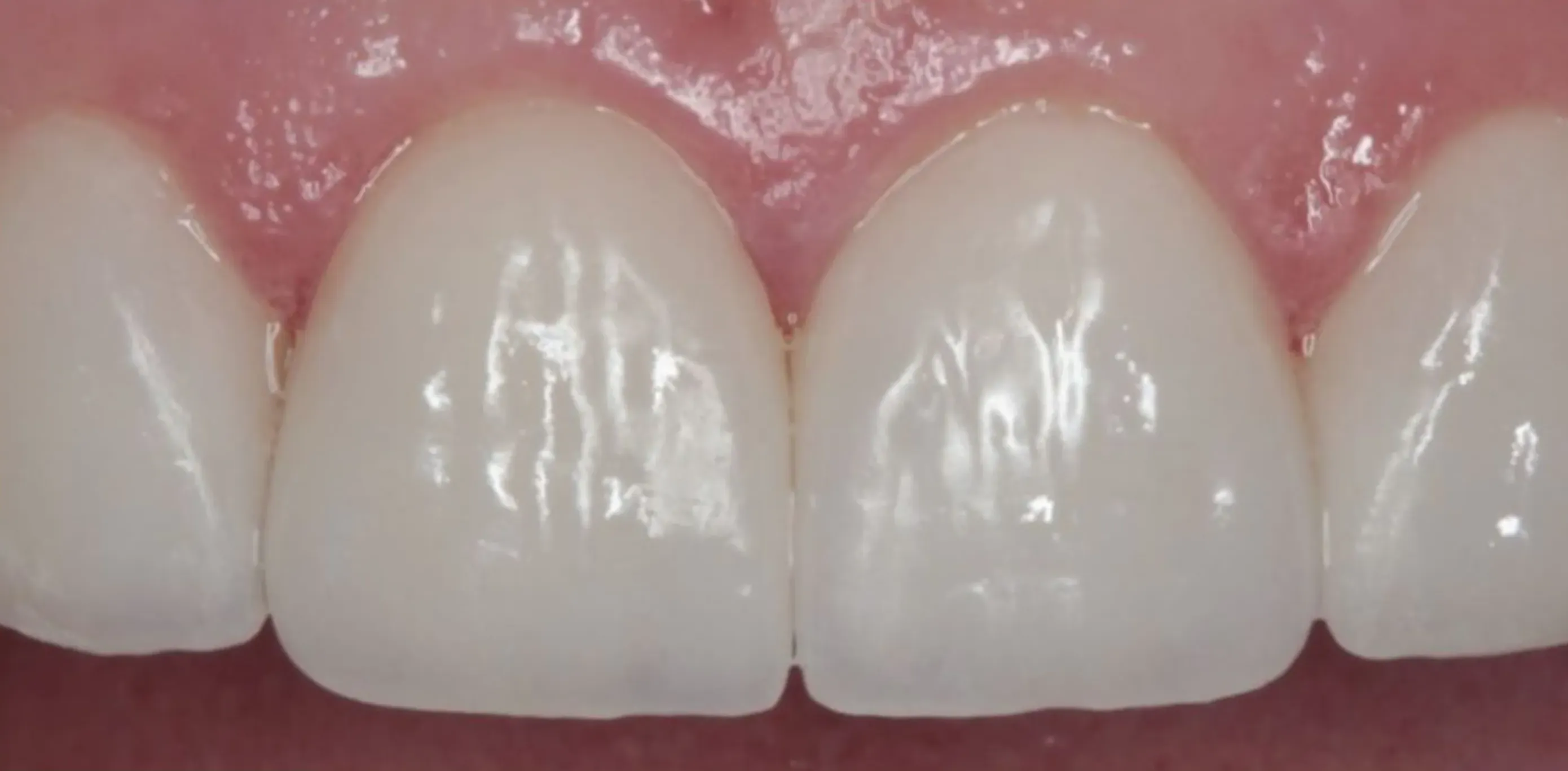 Depois do tratamento odontológico 5