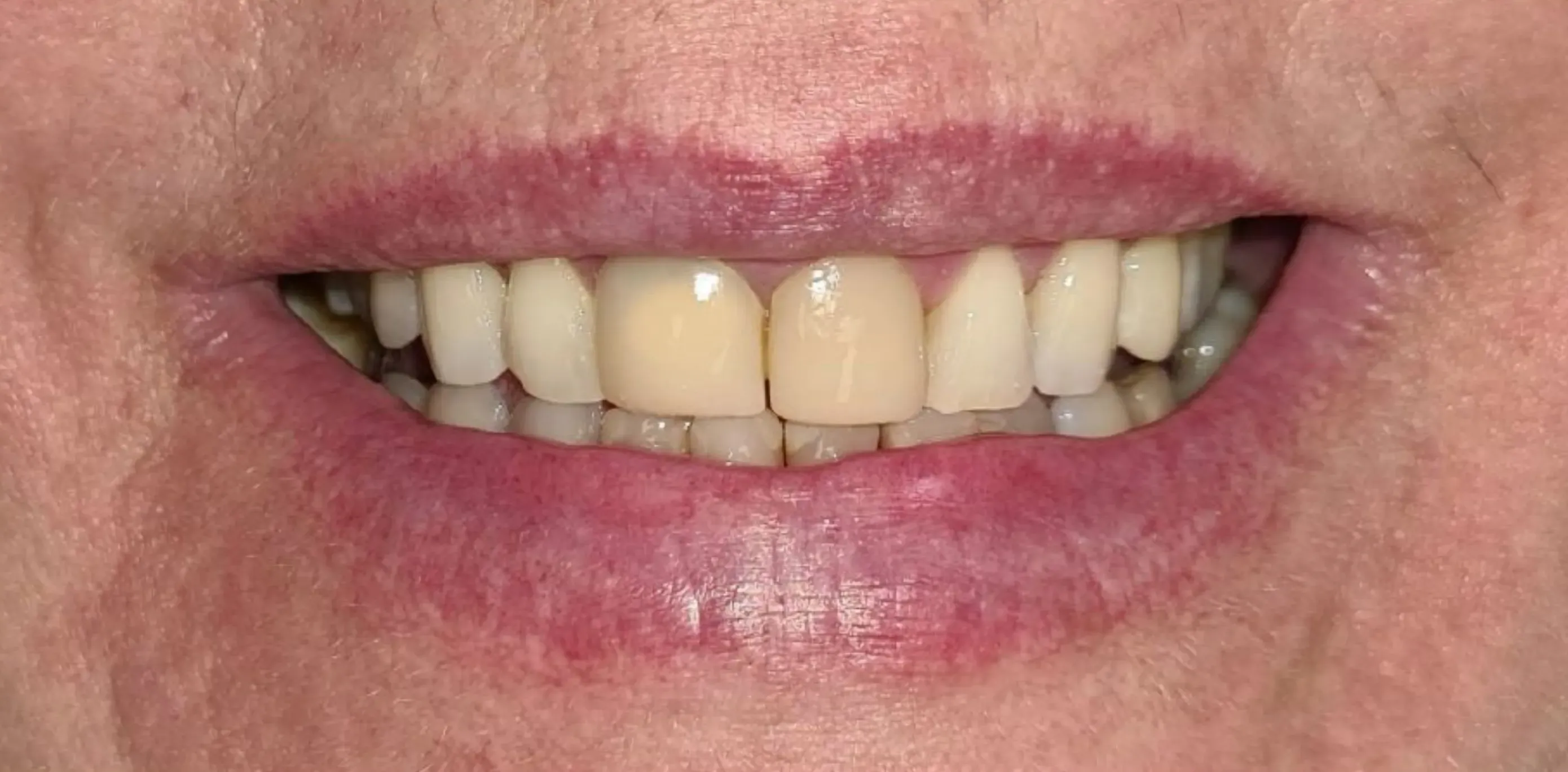 Antes do tratamento odontológico 8