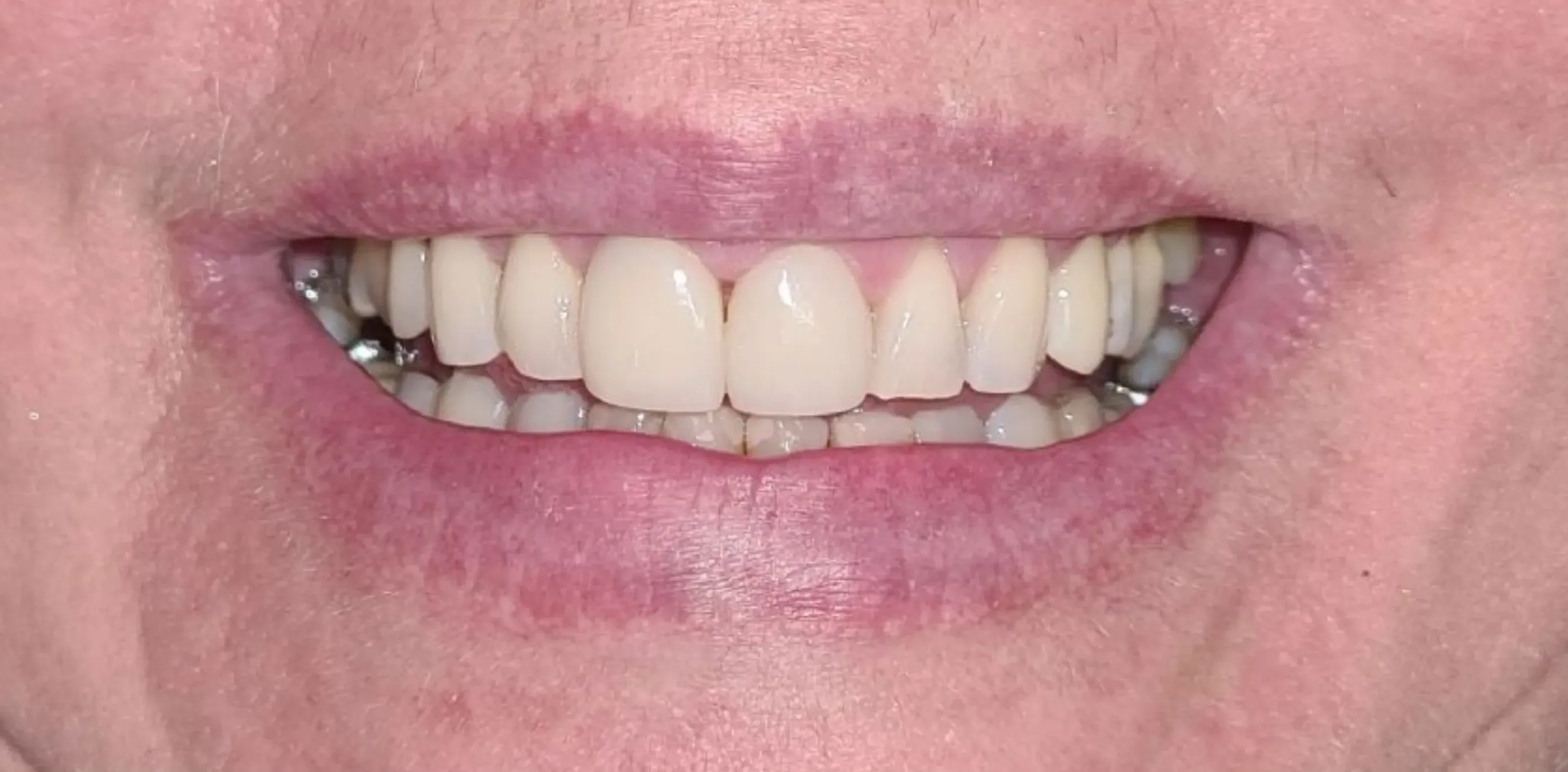 Depois do tratamento odontológico 8