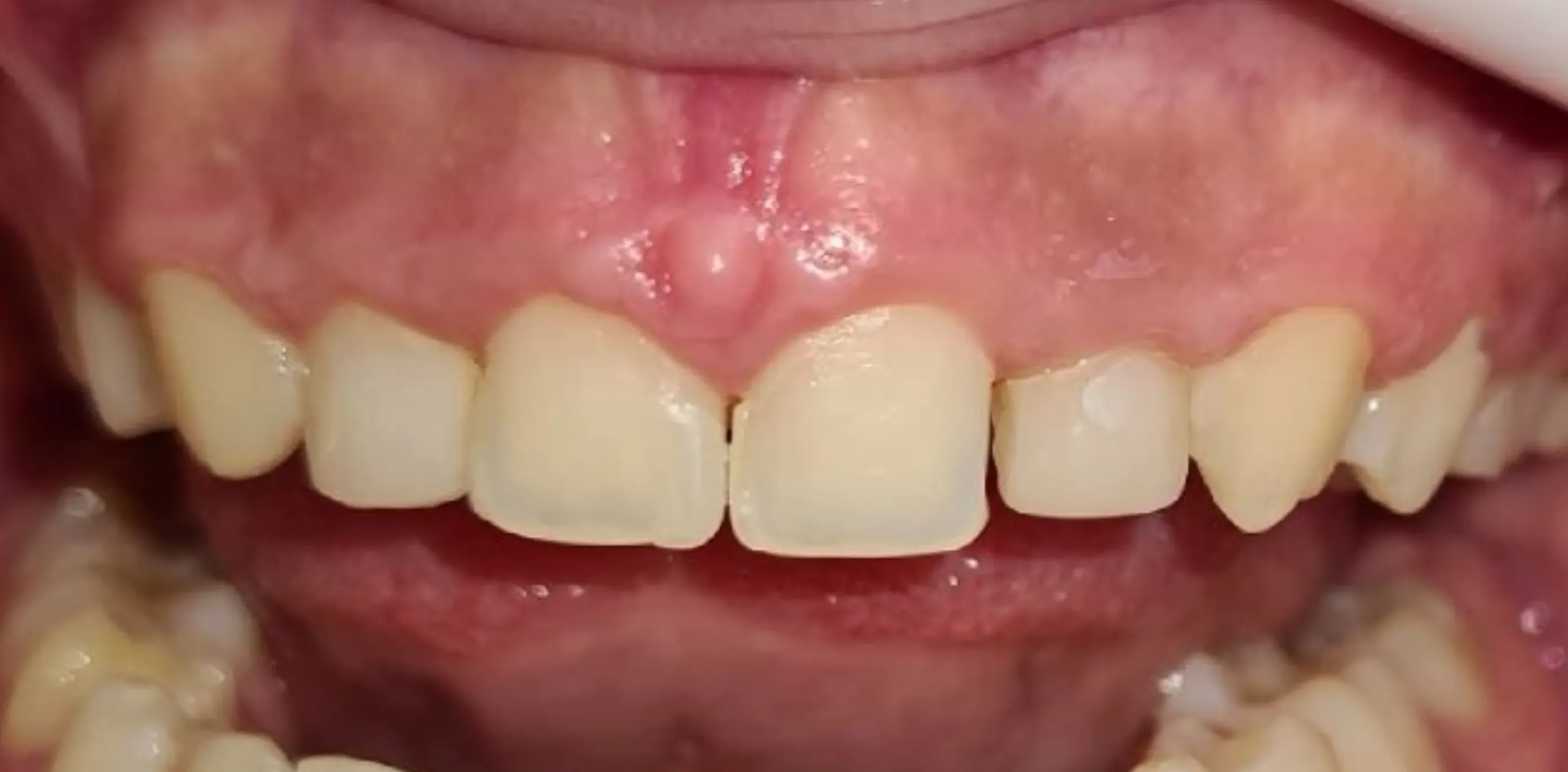 Antes do tratamento odontológico 9