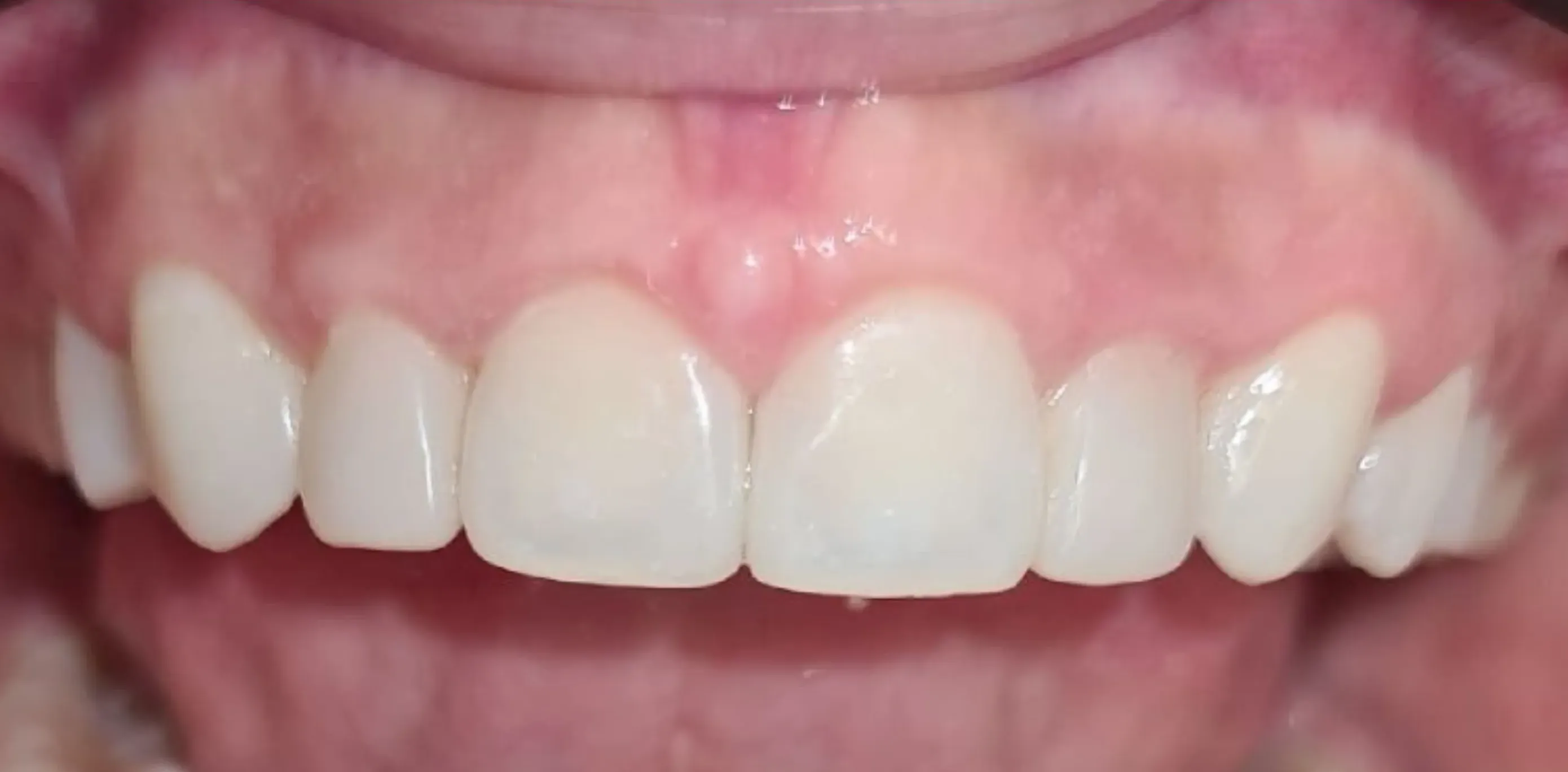 Depois do tratamento odontológico 9