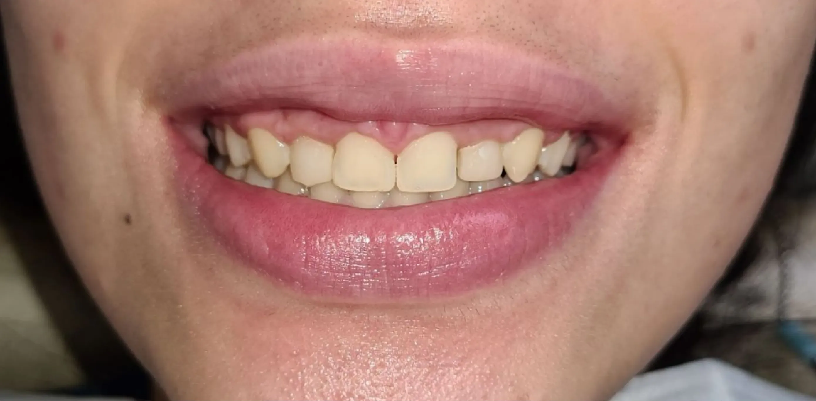 Antes do tratamento odontológico 10