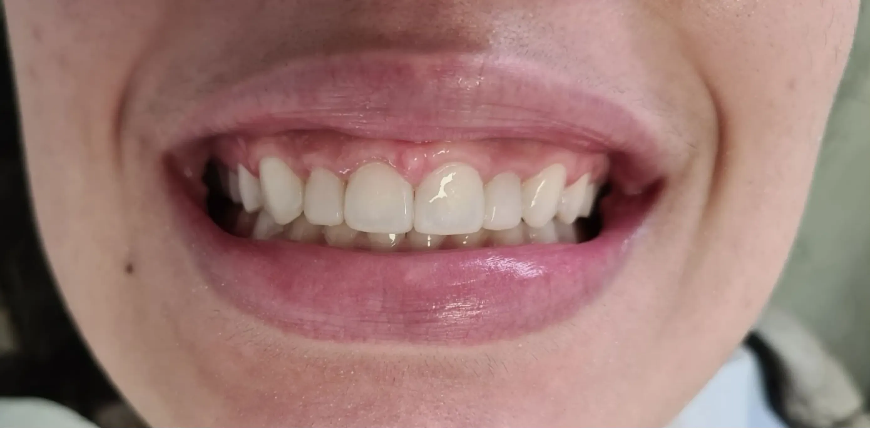 Depois do tratamento odontológico 10