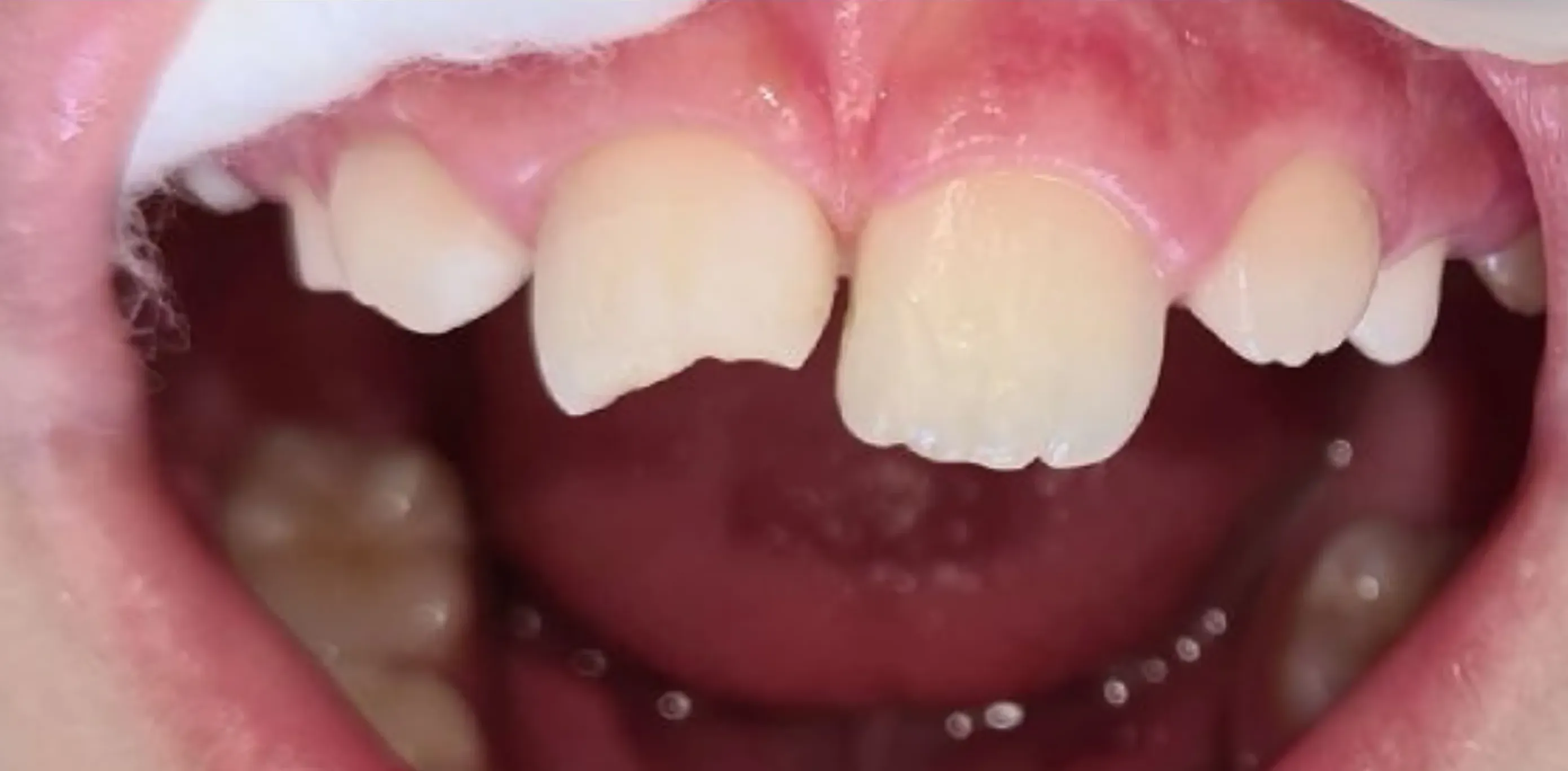 Antes do tratamento odontológico 11