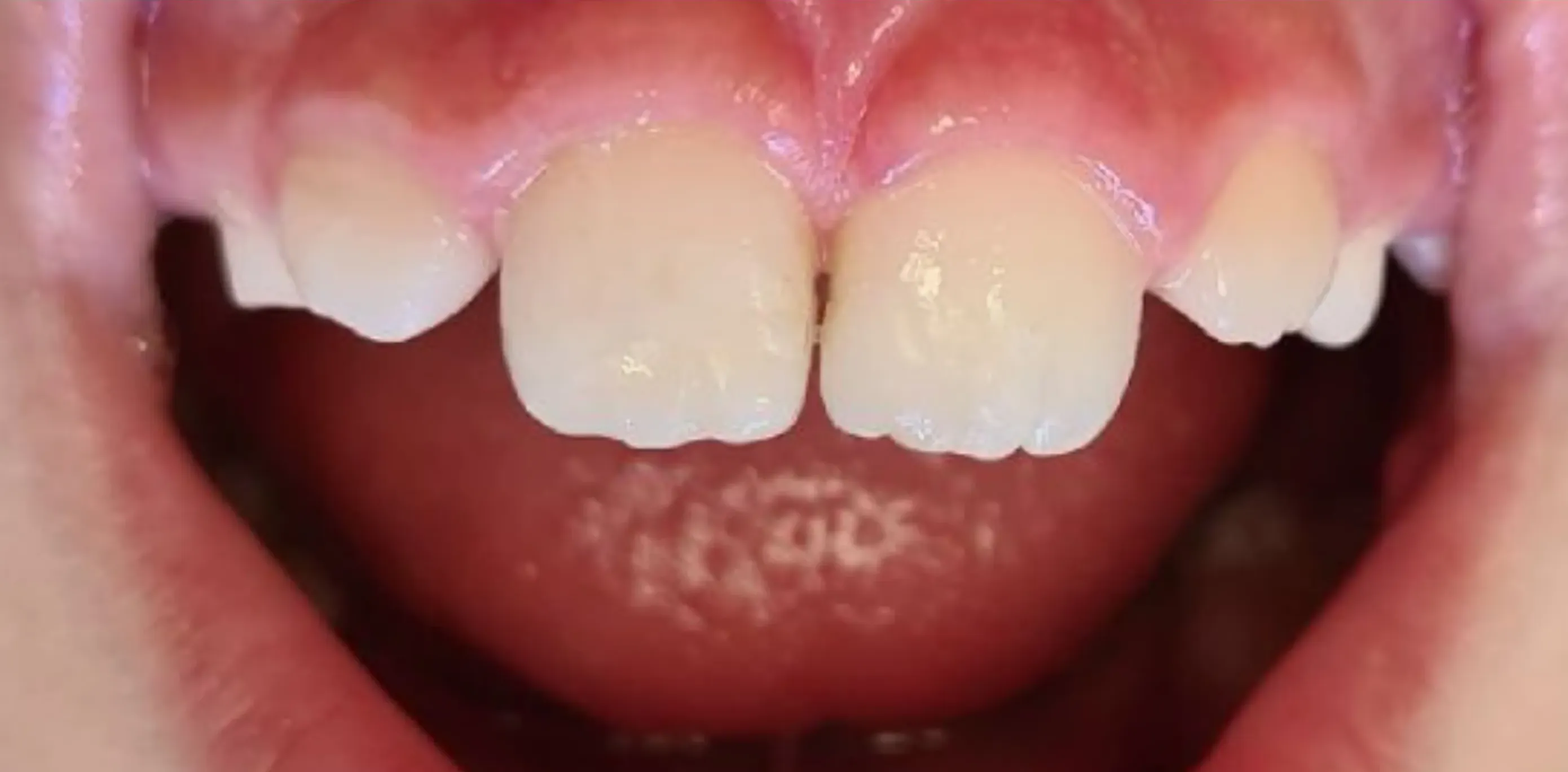 Depois do tratamento odontológico 11