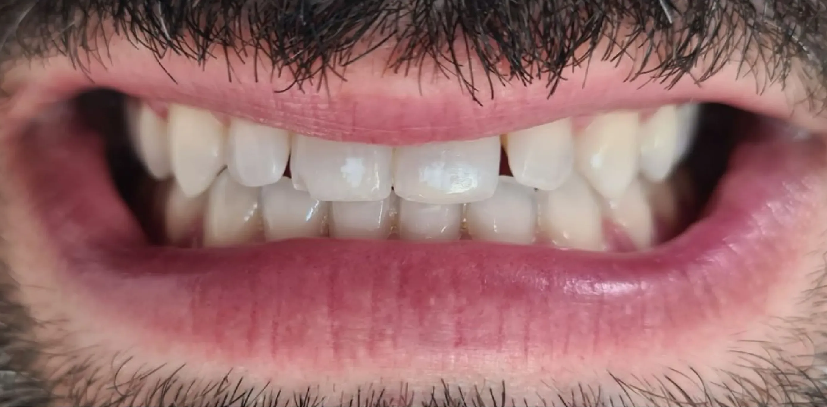 Antes do tratamento odontológico 12