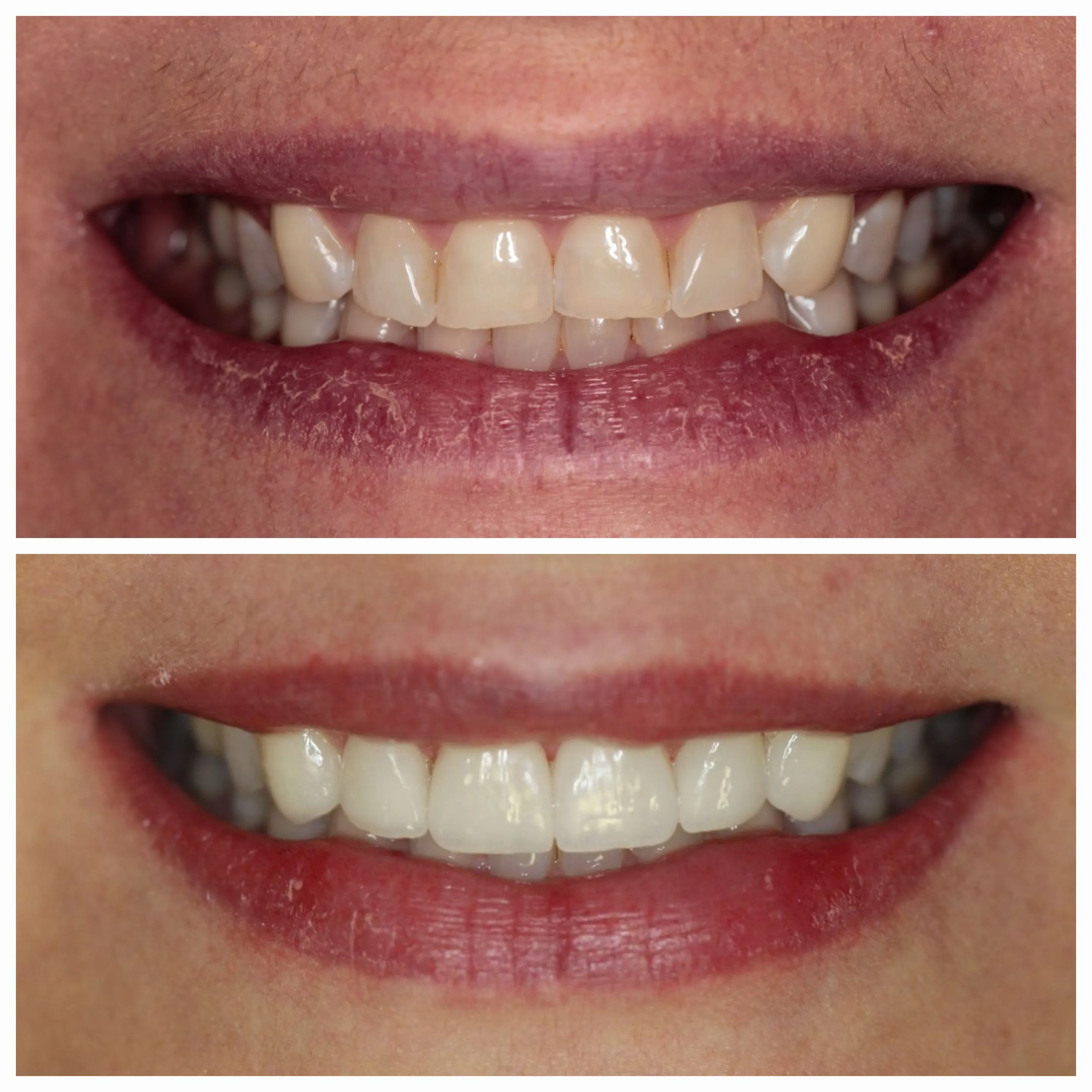 Antes e depois de tratamento odontológico 7