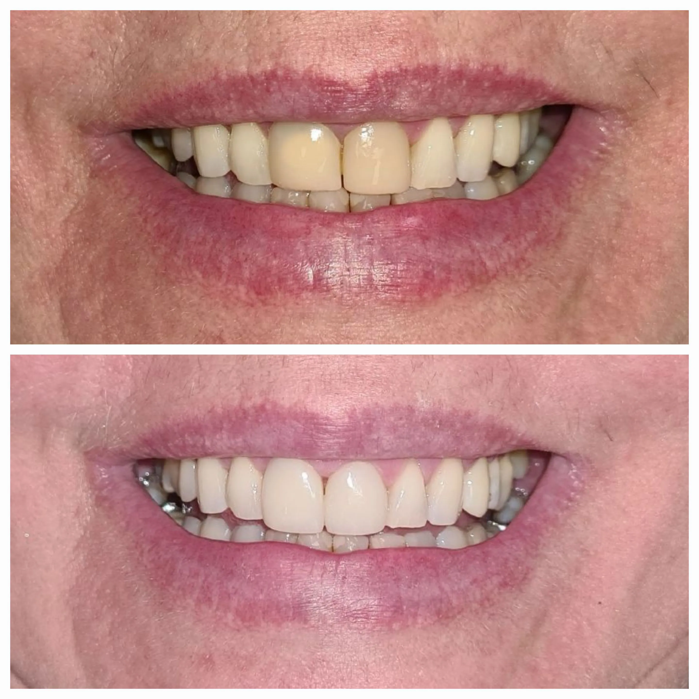 Antes e depois de tratamento odontológico 8