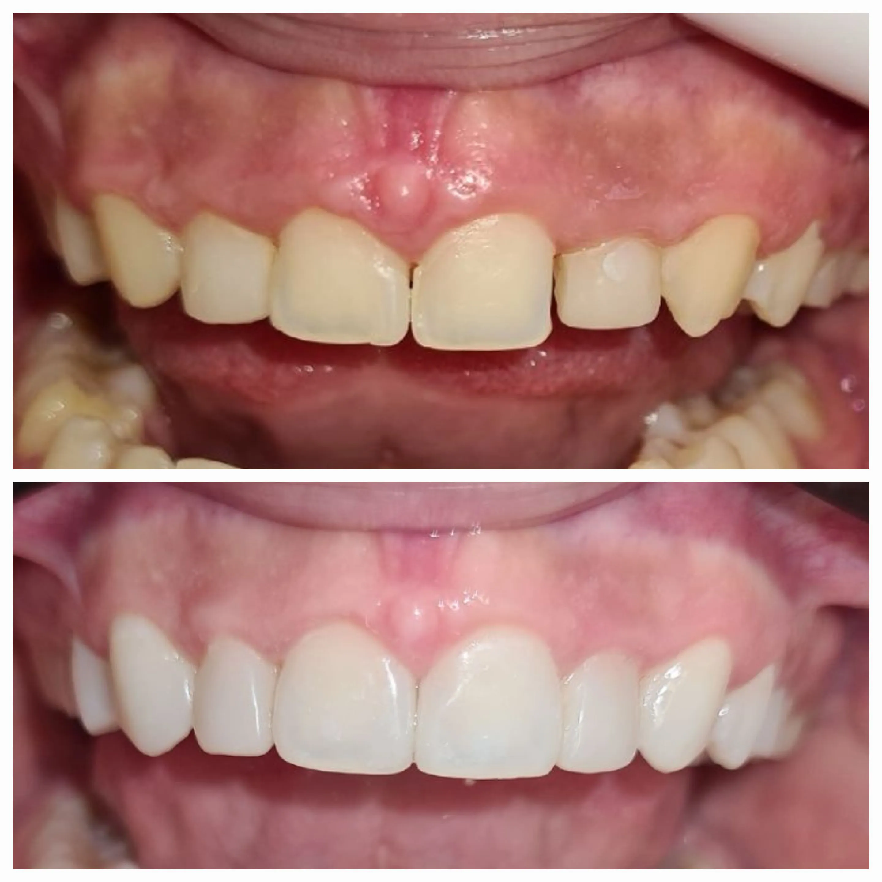 Antes e depois de tratamento odontológico 9
